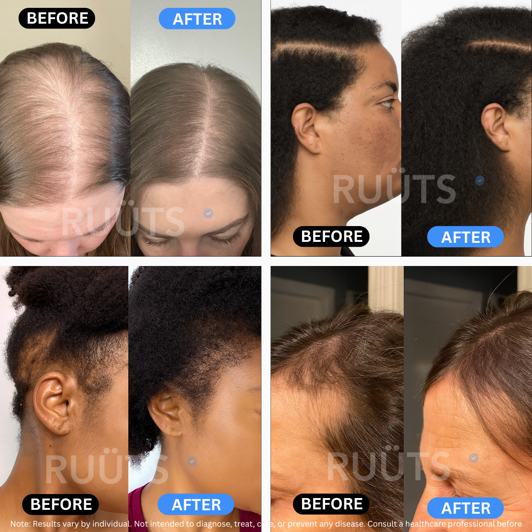 Ruüts Hair Skin Nail Gummies