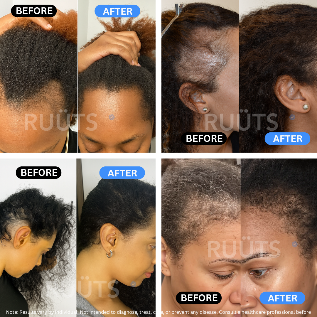 Ruüts Hair Skin Nail Gummies
